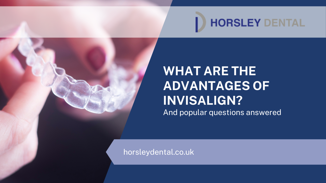 What Are The Advantages Of Invisalign?