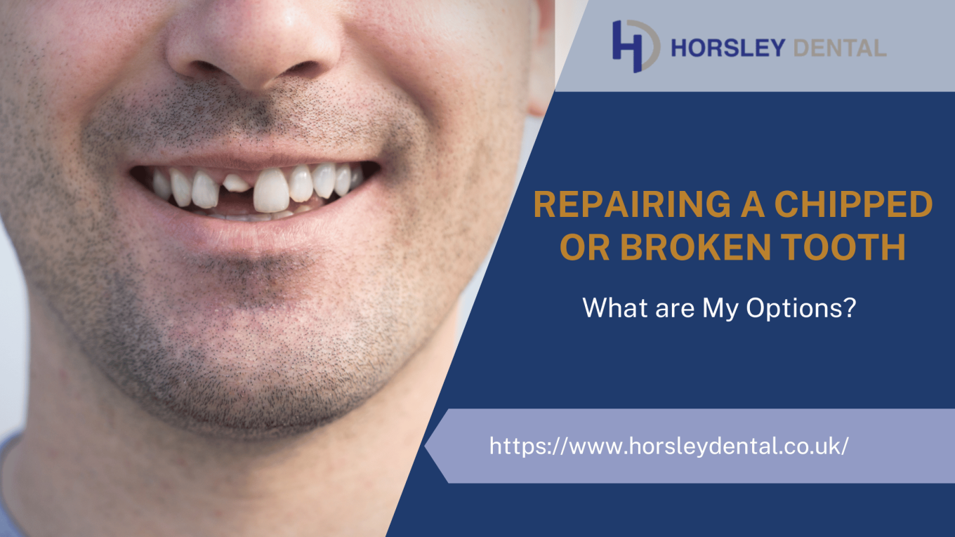 Repairing A Chipped Or Broken Tooth: What Are My Options?