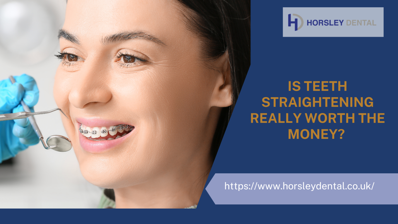 Is Teeth Straightening Really Worth The Money?